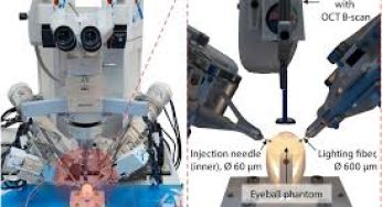 China Kembangkan Robot Bedah Mata Otonom Berteknologi AI